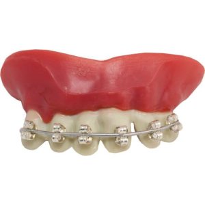 Dentadura aparelho dentário